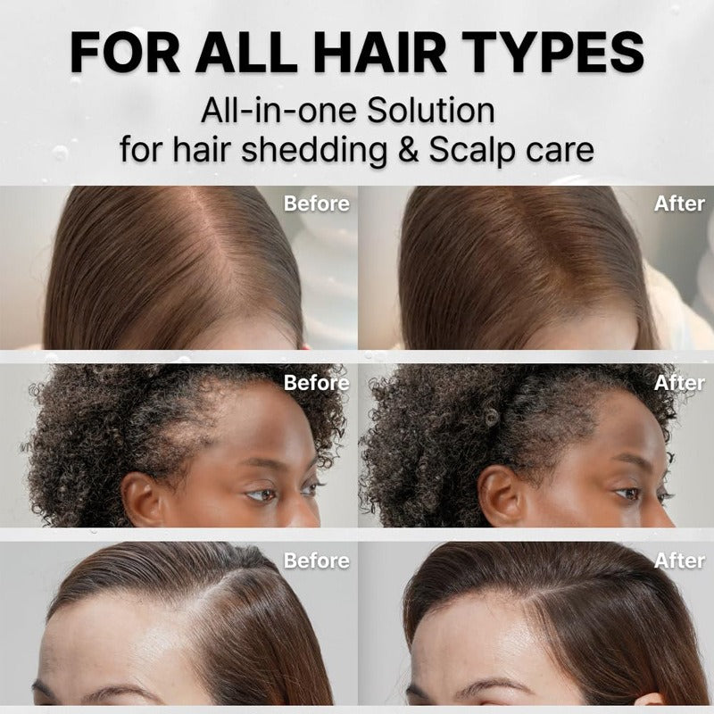 Hair Growth Serum with Massage Brush Applicator
