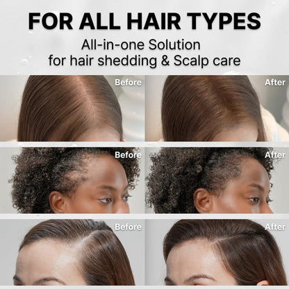 Hair Growth Serum with Massage Brush Applicator